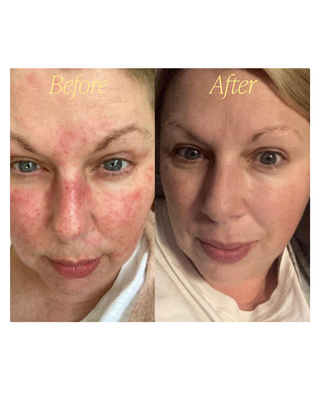 Hero Facial Oil